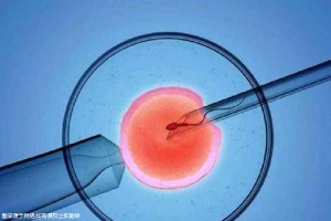代生供卵公司生殖中心